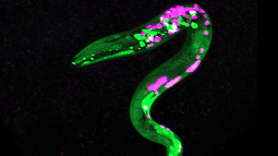 Images of worms that are genetically engineered so that certain neurons and muscles are fluorescent. Green dots are neurons that respond to cannabinoids. 