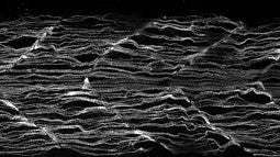 These are the individual muscle fibers in gjd4 mutant 1-day-old zebrafish, visualized through an antibody (F59). The muscle fibers are wavy, wispy, and crinkly and there are disruptions to the sarcomeres.