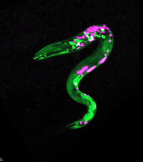 Images of worms that are genetically engineered so that certain neurons and muscles are fluorescent. Green dots are neurons that respond to cannabinoids. 